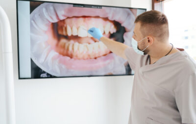 Zalety i wady mostów protetycznych