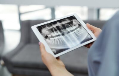 Czy RTG zębów może zaszkodzić zdrowiu?