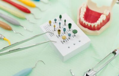 Kiedy lepiej wybrać protezę na czterech implantach zamiast na dwóch?